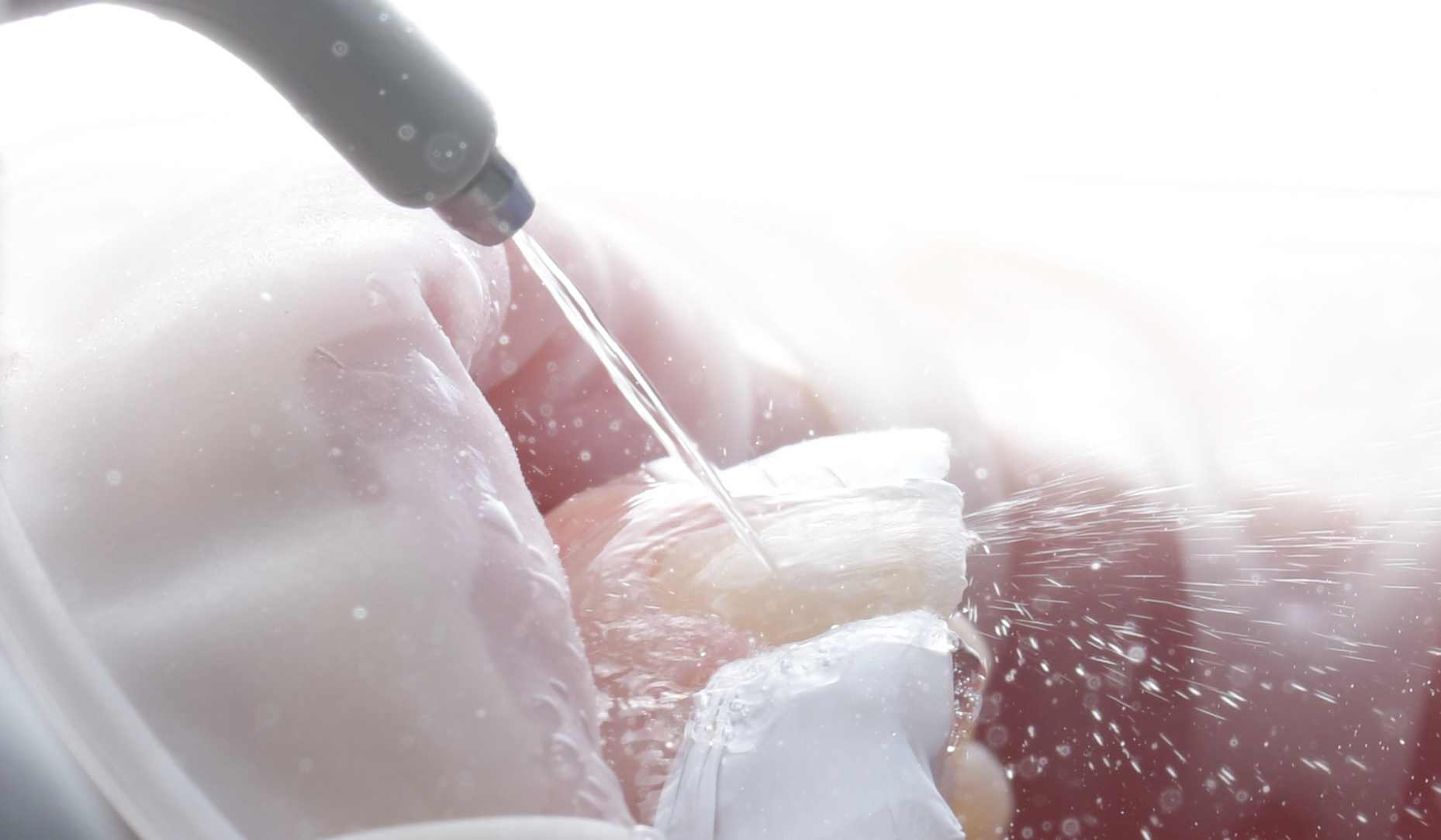 Figure 5b: Thorough rinsing to remove the etchant from the surface.